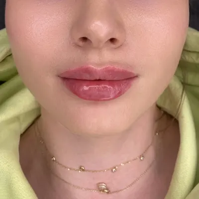 Sylwia Nijaki Kosmetologia Estetyczna